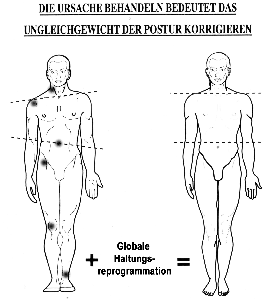 Basis der Globalen Haltungsreprogrammation